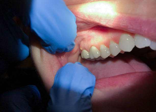 Best Pediatric Emergency Dentist in Traverse City, MI